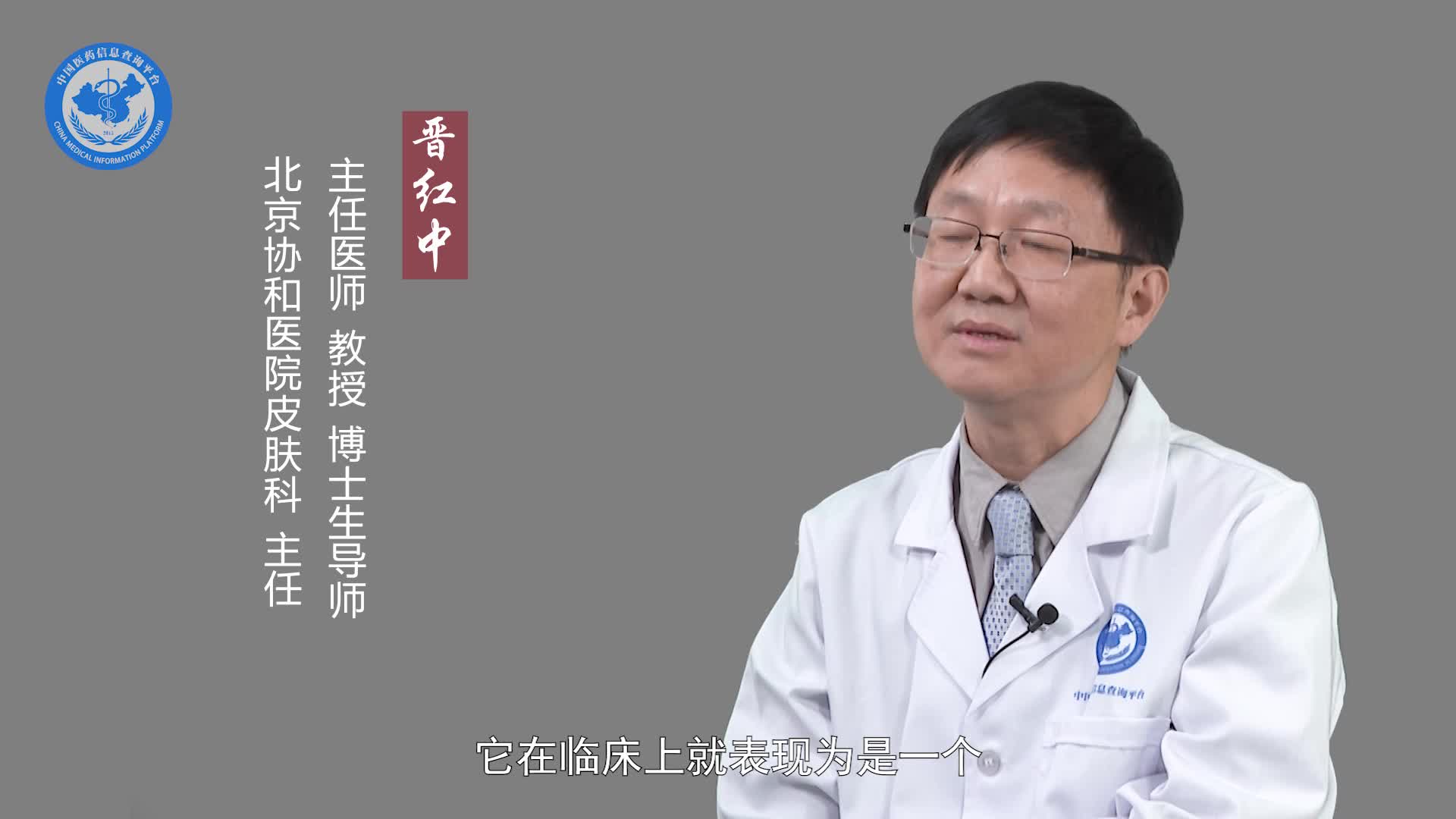 皮肤型红斑狼疮有什么症状？