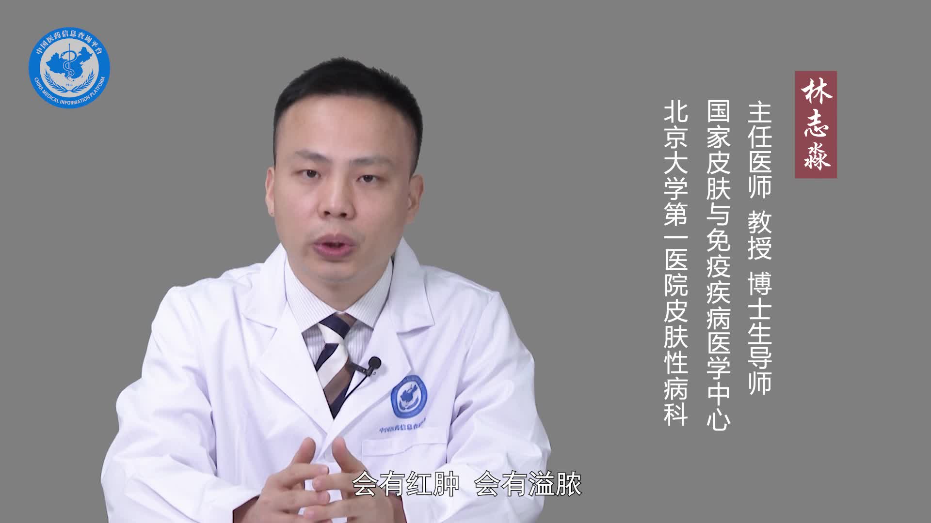 化脓性汗腺炎会传染吗？