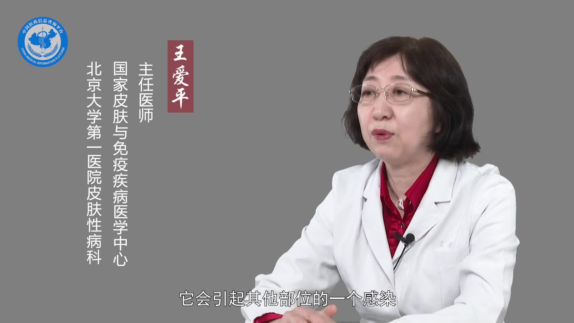 红色毛癣菌会不会传染？